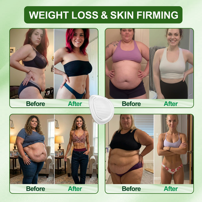 YT[𝟐𝟎𝟐𝟔 𝐍𝐞𝐰 & 𝐔𝐩𝐠𝐫𝐚𝐝𝐞𝐝: 𝟖𝟎% 𝐎𝐅𝐅] ✅ 𝐃𝐑.𝐇𝐎𝐍𝐎𝐑® 𝐋𝐲𝐦𝐩𝐡𝐚𝐭𝐢𝐜 𝐃𝐫𝐚𝐢𝐧𝐚𝐠𝐞 𝐒𝐥𝐢𝐦𝐦𝐢𝐧𝐠 𝐍𝐚𝐧𝐨-𝐌𝐢𝐜𝐫𝐨𝐧𝐞𝐞𝐝𝐥𝐞 𝐏𝐚𝐭𝐜𝐡: 𝐔𝐥𝐭𝐫𝐚-𝐏𝐨𝐭𝐞𝐧𝐭 𝟓× 𝐅𝐨𝐫𝐦𝐮𝐥𝐚 𝐰𝐢𝐭𝐡 𝐋𝐢𝐩𝐨𝐥𝐲𝐭𝐢𝐜 𝐏𝐞𝐩𝐭𝐢𝐝𝐞 𝐂𝐨𝐦𝐩𝐥𝐞𝐱 — 𝐒𝐮𝐩𝐩𝐨𝐫𝐭𝐬 𝐖𝐞𝐢𝐠𝐡𝐭 𝐋𝐨𝐬𝐬 & 𝐋𝐲𝐦𝐩𝐡𝐚𝐭𝐢𝐜 𝐅𝐥𝐨𝐰 — 𝐏𝐥𝐮𝐬 𝐉𝐨𝐢𝐧𝐭 𝐑𝐞𝐥𝐢𝐞𝐟, 𝐁𝐞𝐭𝐭𝐞𝐫 𝐒𝐥𝐞𝐞𝐩 & 𝐌𝐞𝐧𝐭𝐚𝐥 𝐂𝐥𝐚𝐫𝐢𝐭𝐲.
